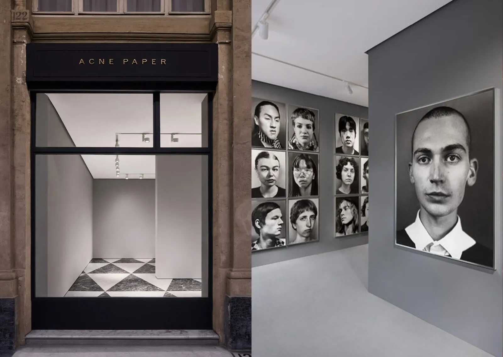 foto acne